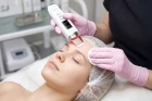Peeling kawitacyjny LumiPeel_6a.jpg